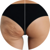 total-body-sculpting-brazilian-butt-lift-up